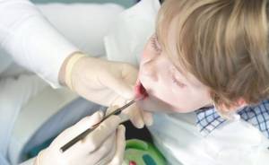 Dentist Pass: Έρχεται το voucher για δωρεάν οδοντιατρικό έλεγχο – Τι είναι και πώς θα λειτουργεί