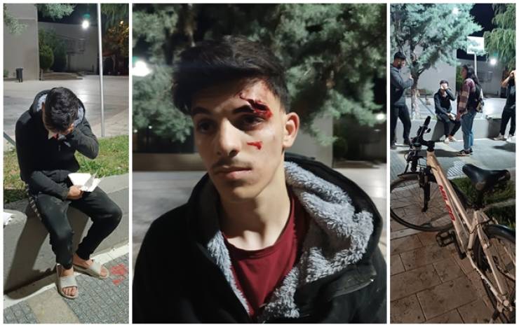 Αλεξάνδρεια:Συνεχείς οι Επιθέσεις Αδέσποτων σε Πολίτες - Τραυματίστηκε νεαρός